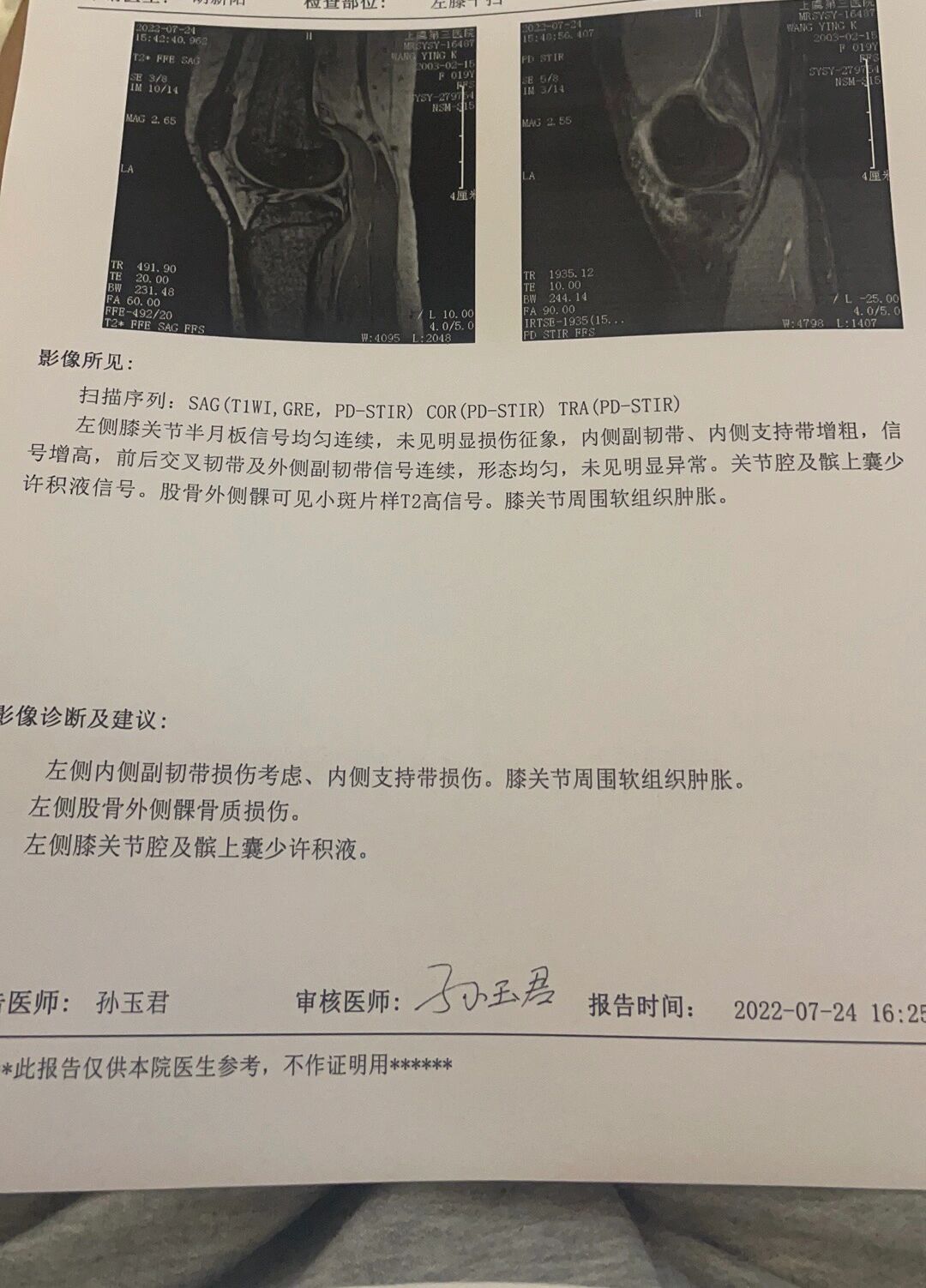 皇冠即时比分-尼克左膝盖韧带撕裂，将缺席数周的简单介绍